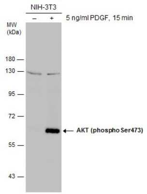 Western Blot: AKT [p Ser473] Antibody [NBP3-13120]
